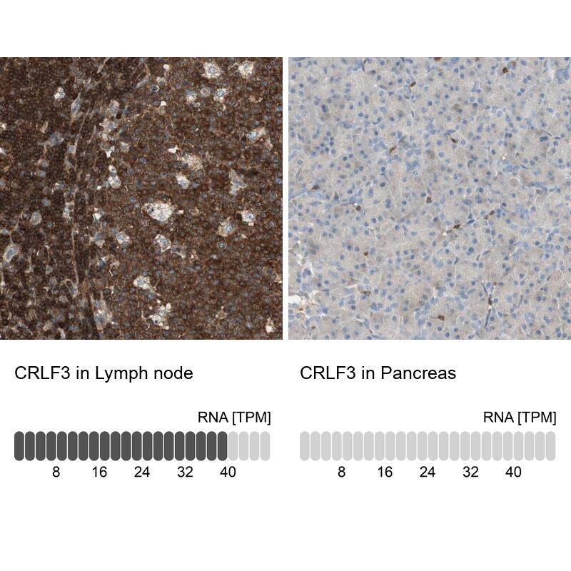 CRLF3 Antibody - BSA Free Immunohistochemistry-Paraffin: CRLF3 Antibody - BSA Free [NBP1-84382]