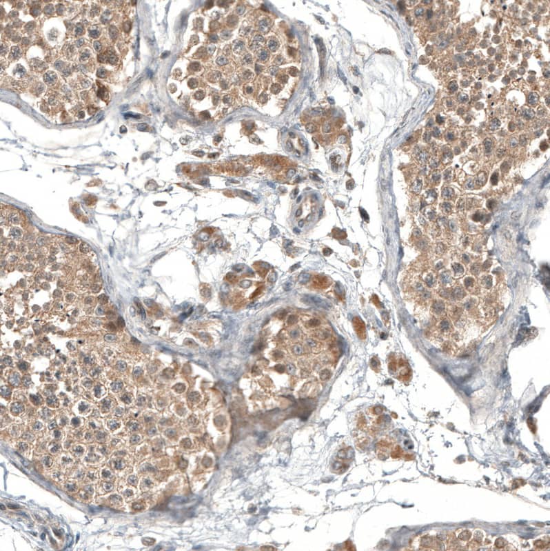GADD45G Antibody - BSA Free Immunohistochemistry-Paraffin: GADD45G Antibody - BSA Free [NBP1-84385]