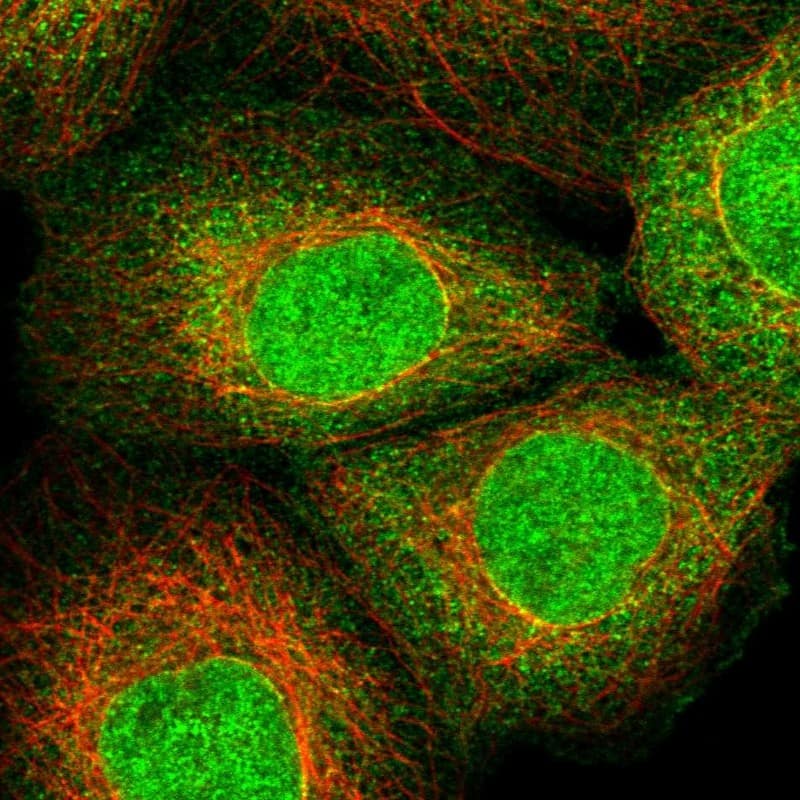 ZNF213 Antibody - BSA Free Immunocytochemistry/ Immunofluorescence: ZNF213 Antibody [NBP1-84386]