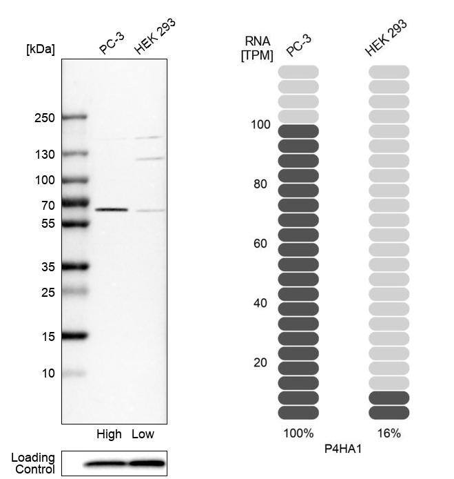 P4HA1 Antibody - BSA Free Western Blot: P4HA1 Antibody - BSA Free [NBP1-84398]
