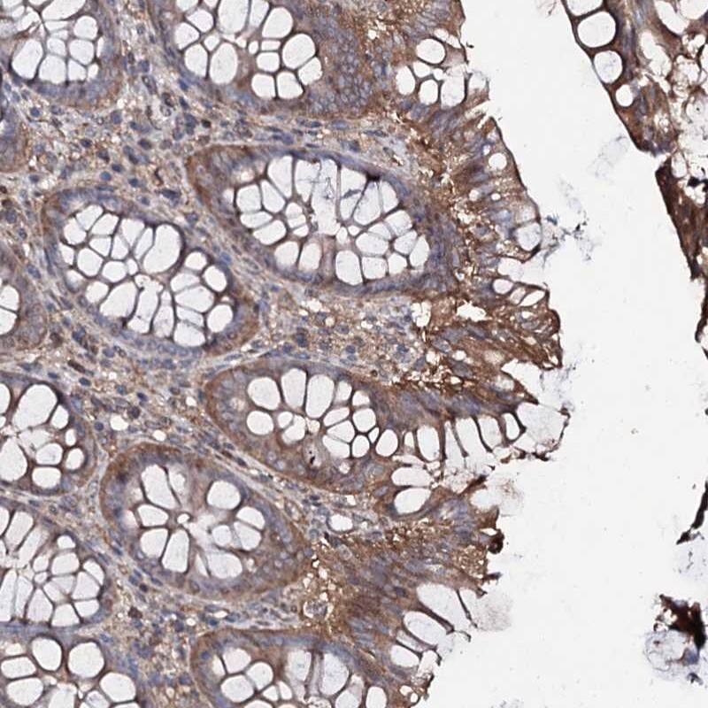 COG6 Antibody - BSA Free Immunohistochemistry-Paraffin: COG6 Antibody [NBP1-84410]