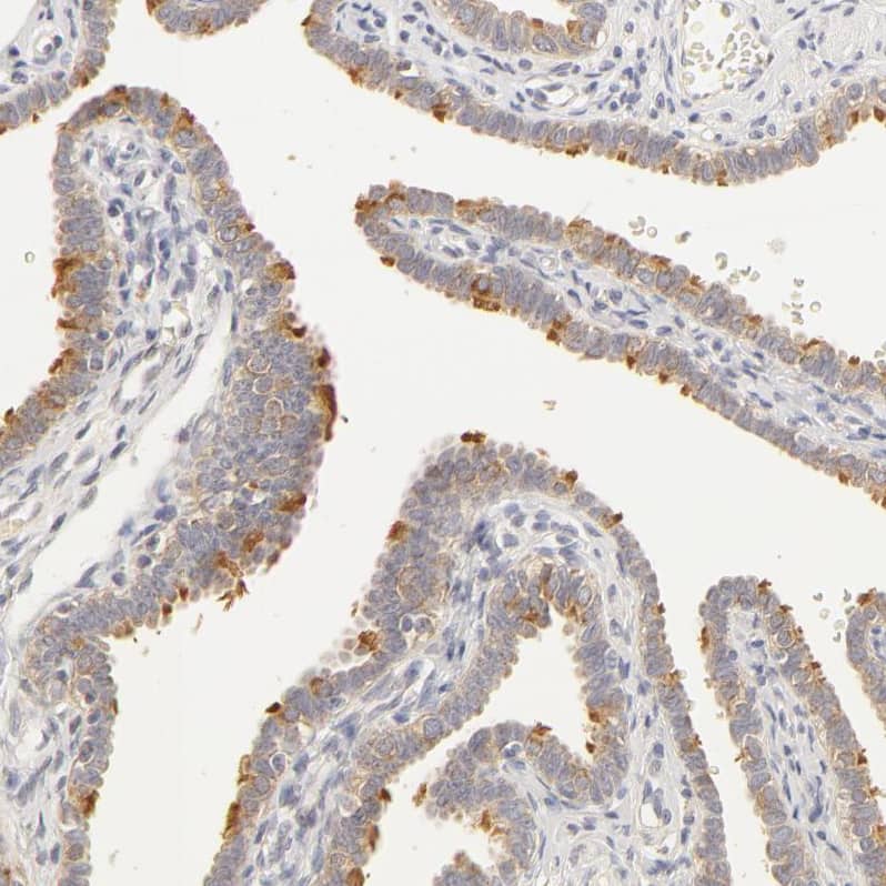 RPGR Antibody - BSA Free Immunohistochemistry-Paraffin: RPGR Antibody - BSA Free [NBP1-84412]
