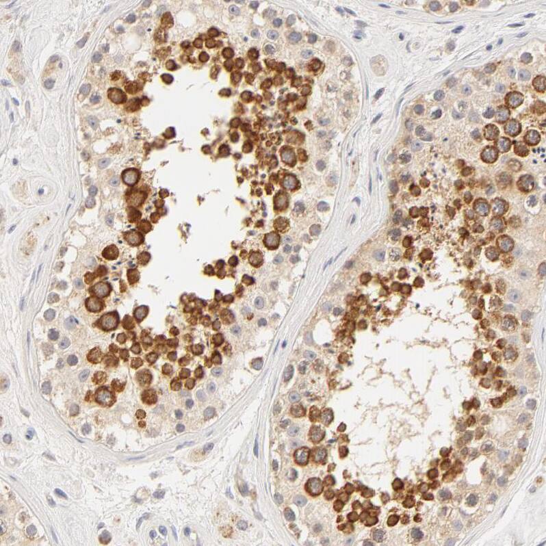 RPGR Antibody - BSA Free Immunohistochemistry-Paraffin: RPGR Antibody - BSA Free [NBP1-84412]