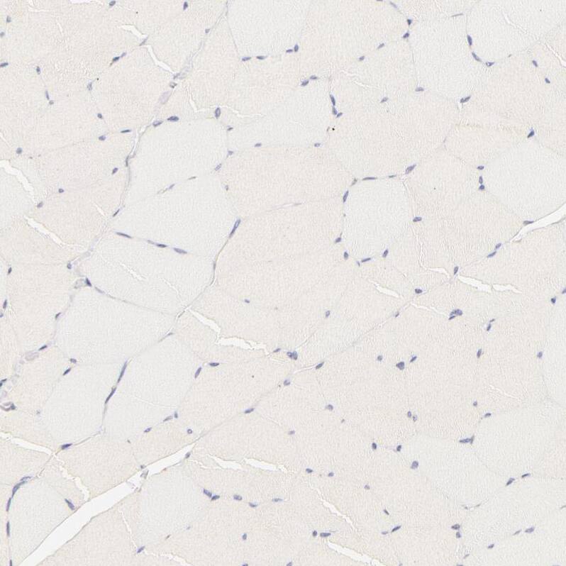 RPGR Antibody - BSA Free Immunohistochemistry-Paraffin: RPGR Antibody - BSA Free [NBP1-84412]