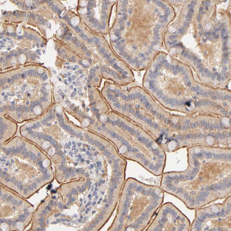 RPGR Antibody - BSA Free Immunohistochemistry-Paraffin: RPGR Antibody - BSA Free [NBP1-84412]