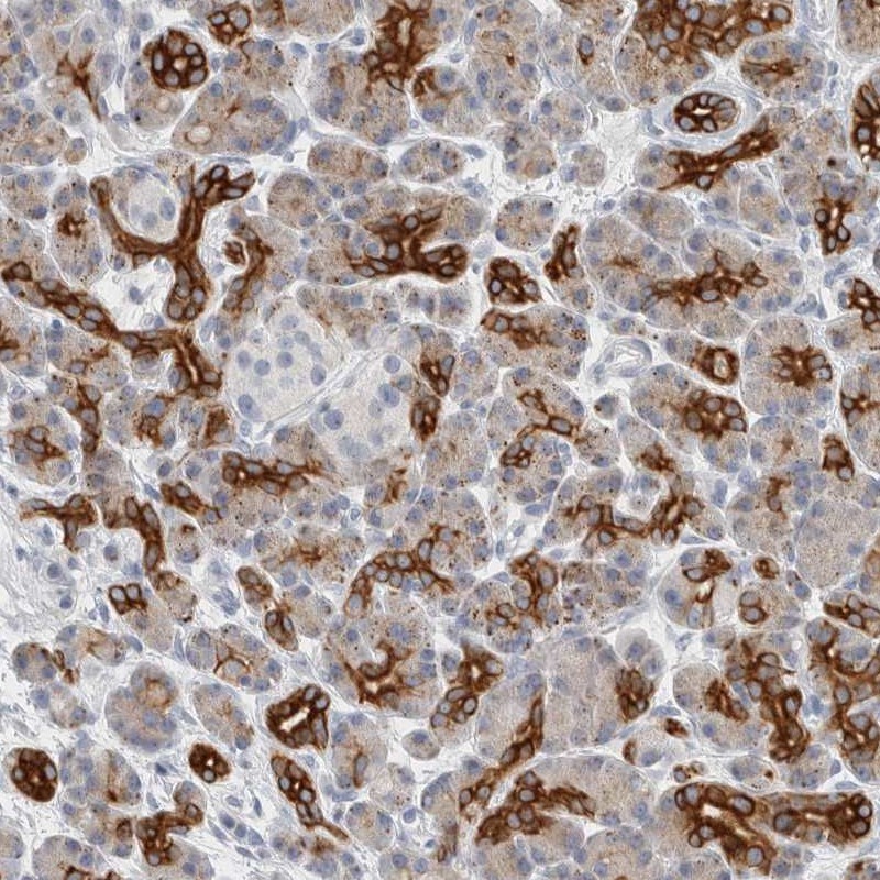 SLC28A3 Antibody - BSA Free Immunohistochemistry-Paraffin: SLC28A3 Antibody - BSA Free [NBP1-84418]