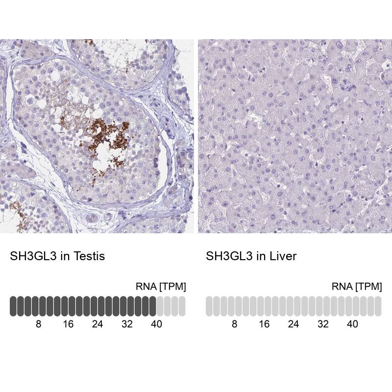 SH3GL3 Antibody - BSA Free Immunohistochemistry-Paraffin: SH3GL3 Antibody - BSA Free [NBP1-84419]