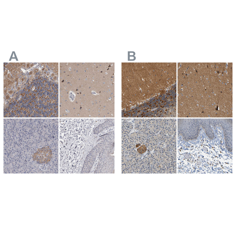 GDAP1 Antibody - BSA Free Immunohistochemistry-Paraffin: GDAP1 Antibody - BSA Free [NBP1-84429]