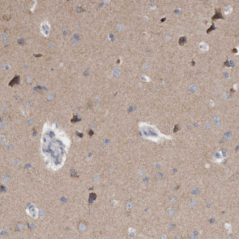 GDAP1 Antibody - BSA Free Immunohistochemistry-Paraffin: GDAP1 Antibody - BSA Free [NBP1-84429]
