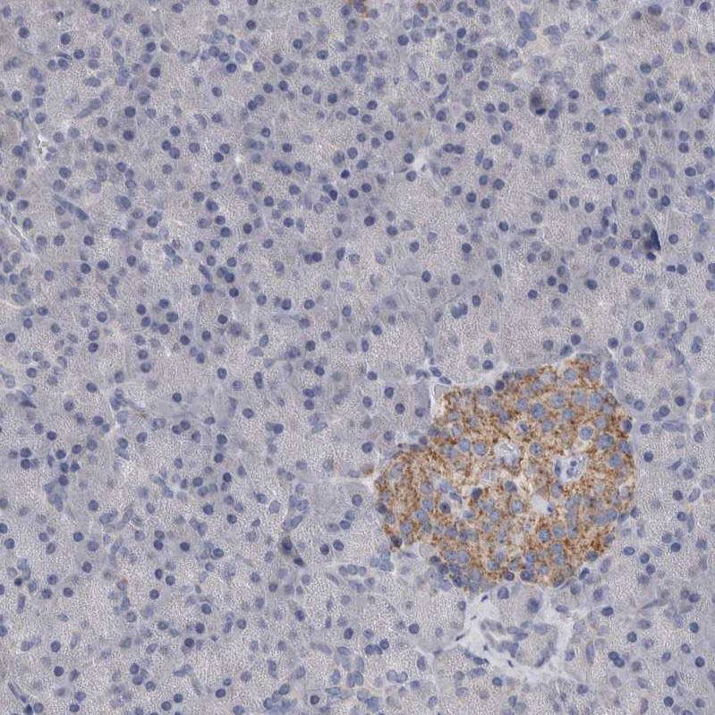 GDAP1 Antibody - BSA Free Immunohistochemistry-Paraffin: GDAP1 Antibody - BSA Free [NBP1-84429]