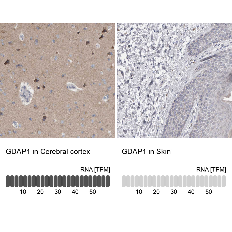 GDAP1 Antibody - BSA Free Immunohistochemistry-Paraffin: GDAP1 Antibody - BSA Free [NBP1-84429]