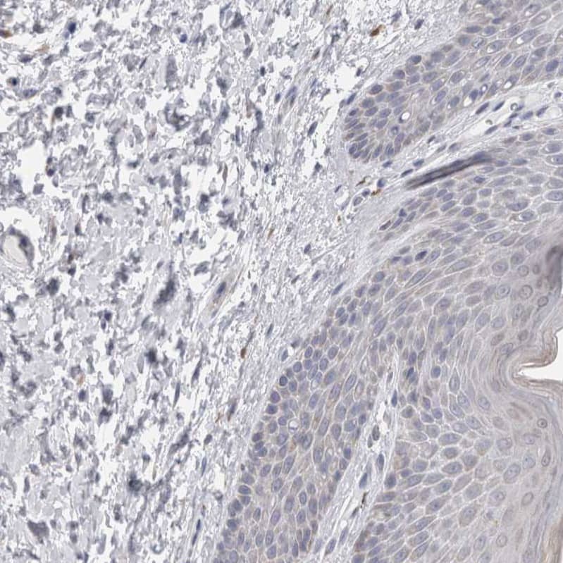 GDAP1 Antibody - BSA Free Immunohistochemistry-Paraffin: GDAP1 Antibody - BSA Free [NBP1-84429]