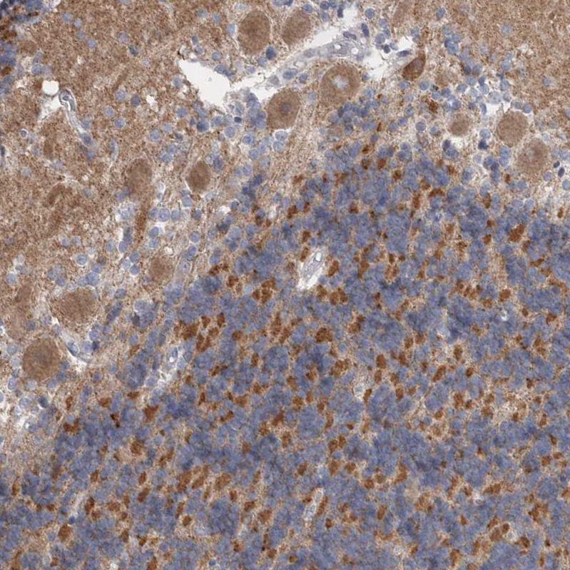 GDAP1 Antibody - BSA Free Immunohistochemistry-Paraffin: GDAP1 Antibody - BSA Free [NBP1-84429]