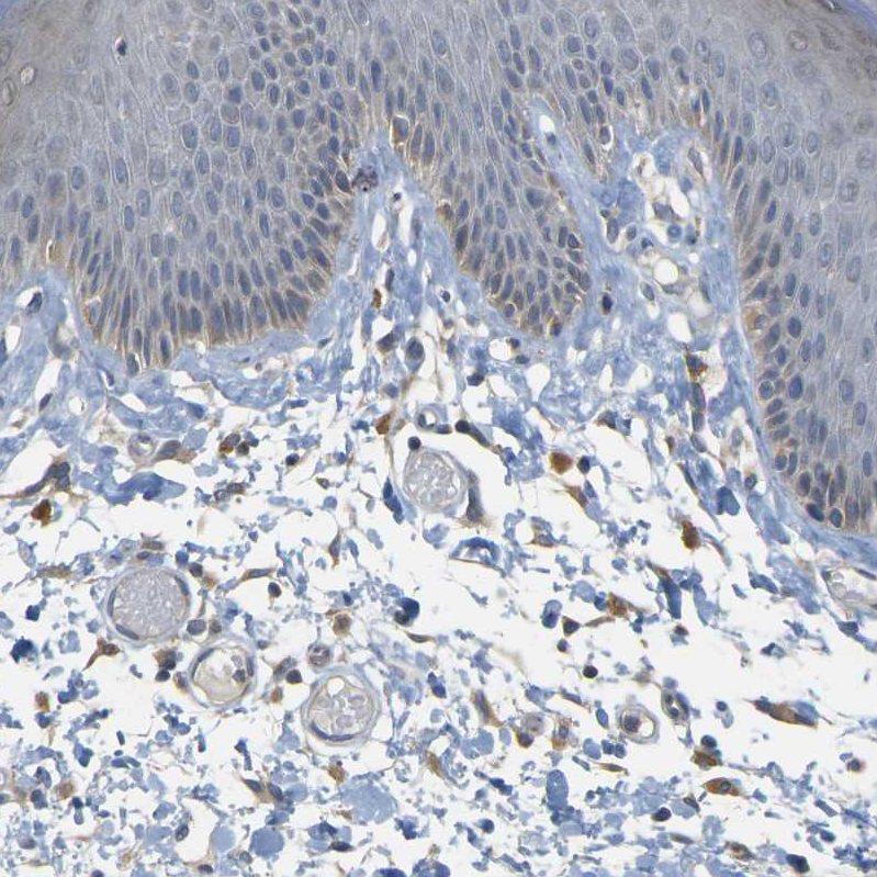 GDAP1 Antibody - BSA Free Immunohistochemistry-Paraffin: GDAP1 Antibody - BSA Free [NBP1-84430]