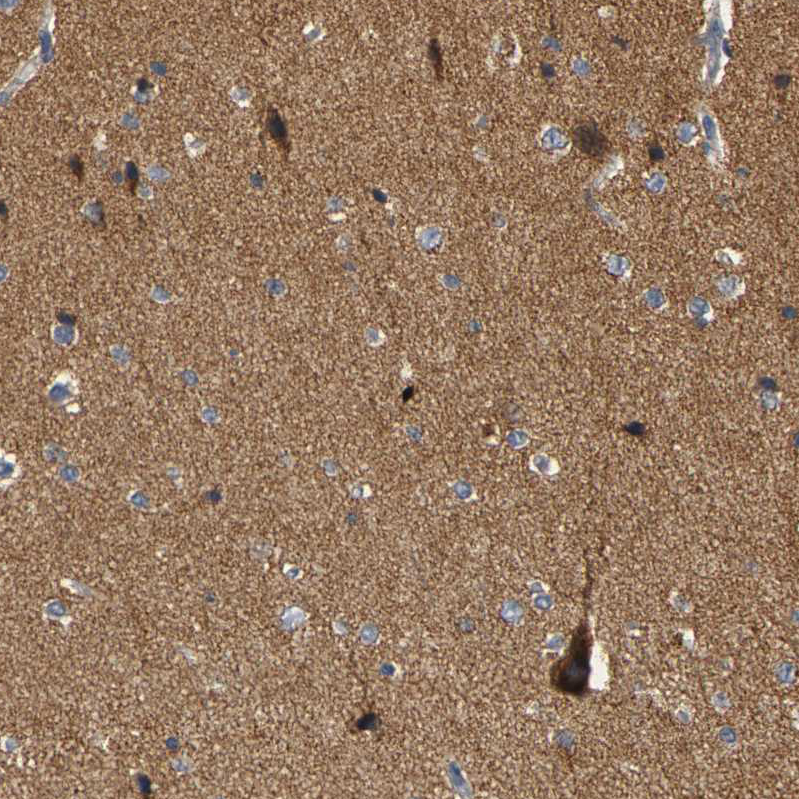 GDAP1 Antibody - BSA Free Immunohistochemistry-Paraffin: GDAP1 Antibody - BSA Free [NBP1-84430]