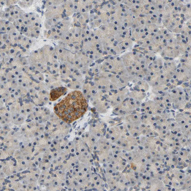 GDAP1 Antibody - BSA Free Immunohistochemistry-Paraffin: GDAP1 Antibody - BSA Free [NBP1-84430]