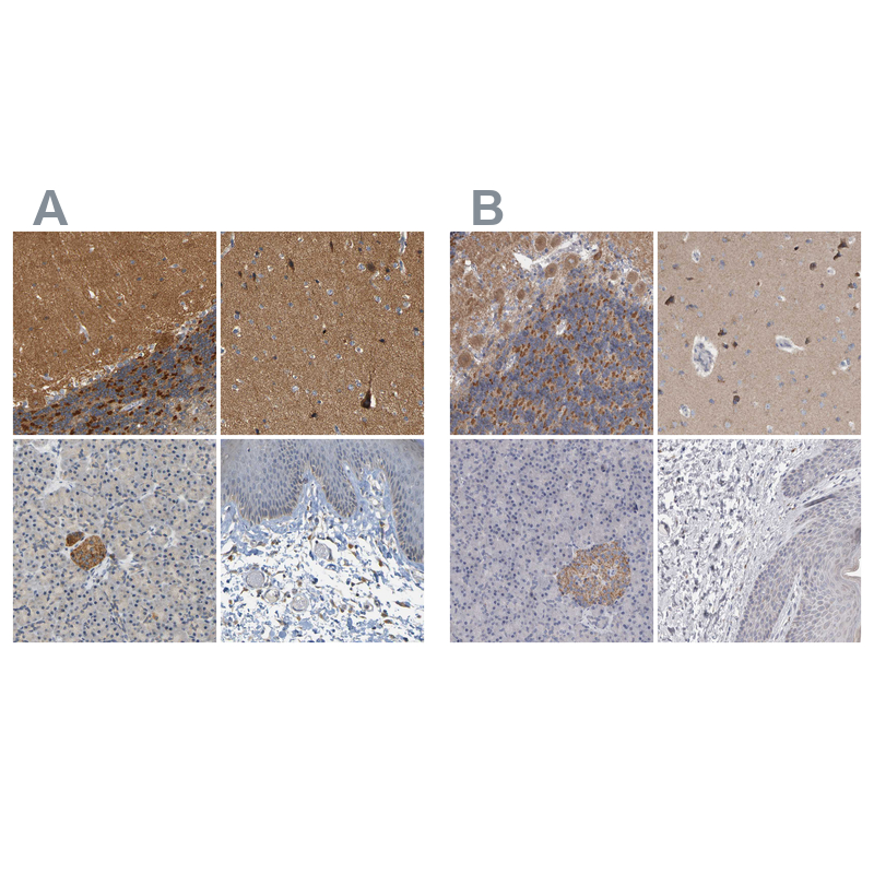 GDAP1 Antibody - BSA Free Immunohistochemistry-Paraffin: GDAP1 Antibody - BSA Free [NBP1-84430]