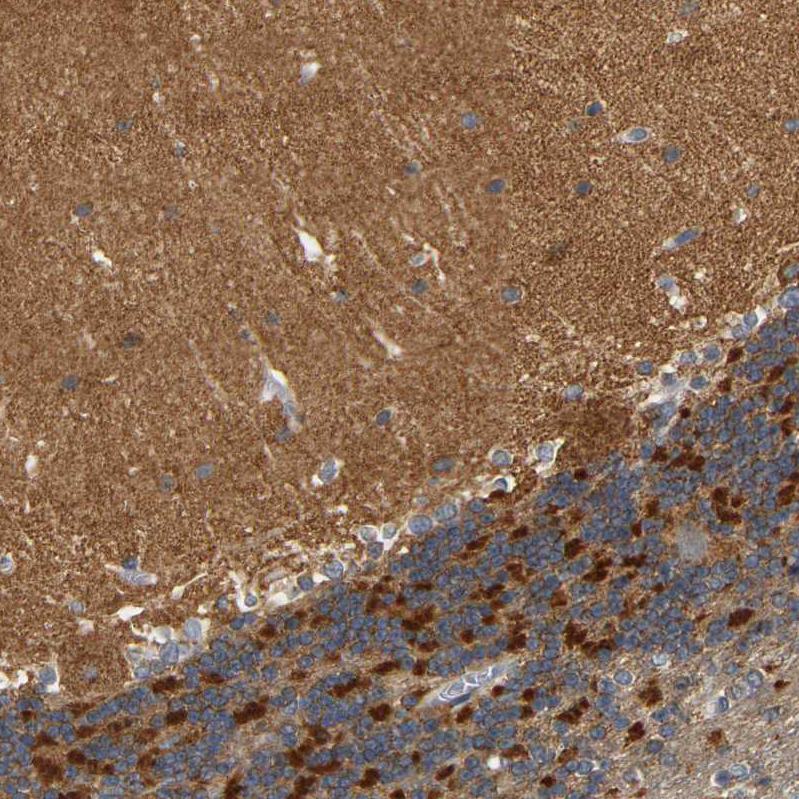 GDAP1 Antibody - BSA Free Immunohistochemistry-Paraffin: GDAP1 Antibody - BSA Free [NBP1-84430]