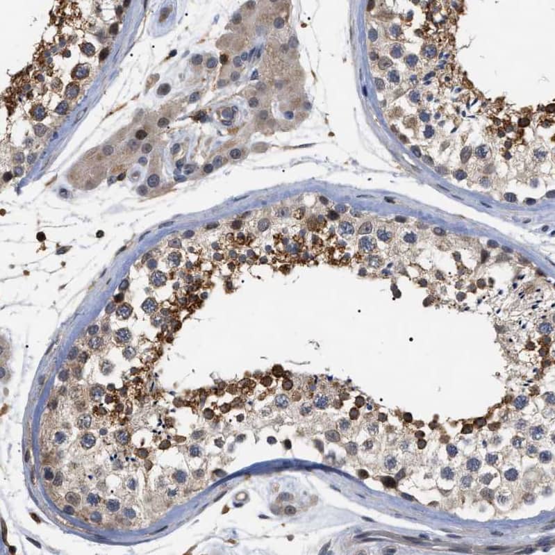 CD300a/LMIR1 Antibody - BSA Free Immunohistochemistry-Paraffin: CD300a/LMIR1 Antibody [NBP1-84431]