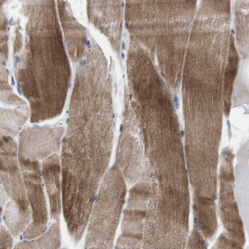 CD300c Antibody - BSA Free Immunohistochemistry-Paraffin: CD300c Antibody [NBP1-84432]