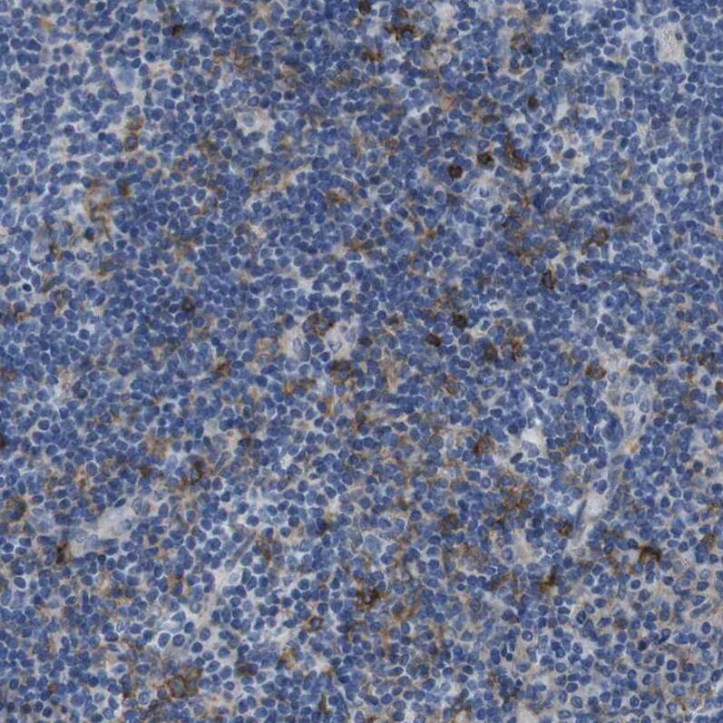 CD300c Antibody - BSA Free Immunohistochemistry-Paraffin: CD300c Antibody [NBP1-84432]