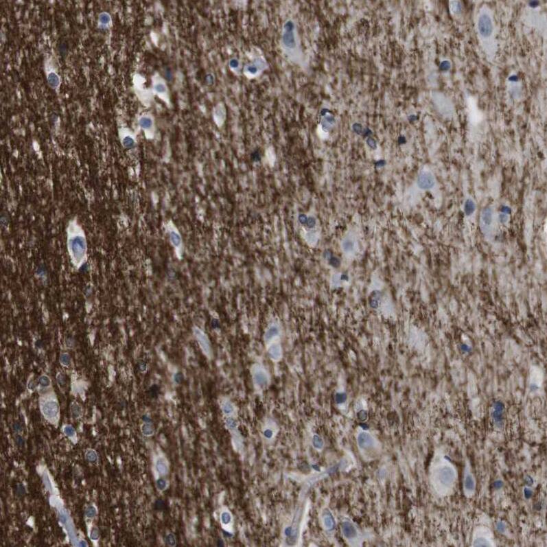 CD300c Antibody - BSA Free Immunohistochemistry-Paraffin: CD300c Antibody [NBP1-84432]