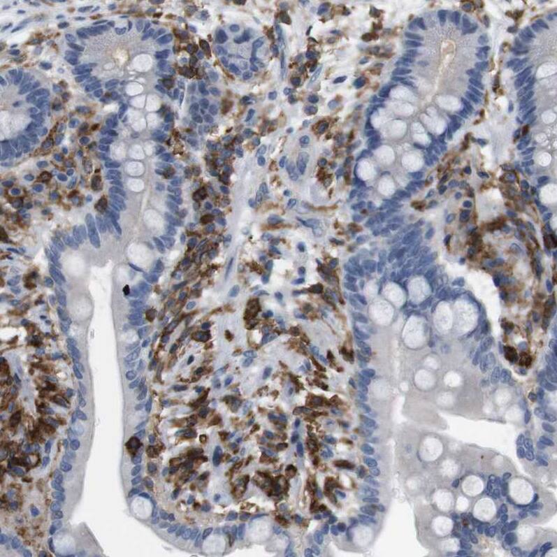 CD300c Antibody - BSA Free Immunohistochemistry-Paraffin: CD300c Antibody [NBP1-84432]