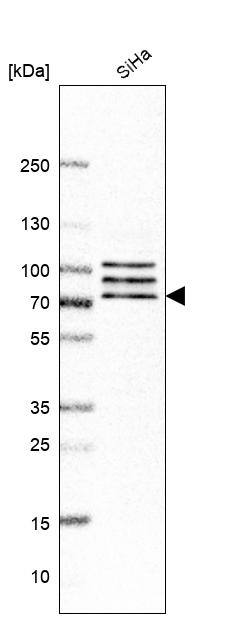 CNOT4 Antibody - BSA Free Western Blot: CNOT4 Antibody - BSA Free [NBP1-84439]