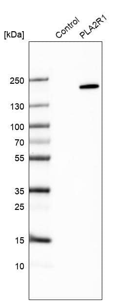 PLA2R1 Antibody - BSA Free Western Blot: PLA2R1 Antibody - BSA Free [NBP1-84449]