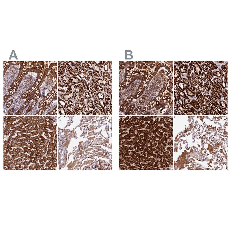 CLYBL Antibody - BSA Free Immunohistochemistry-Paraffin: CLYBL Antibody - BSA Free [NBP1-84453]