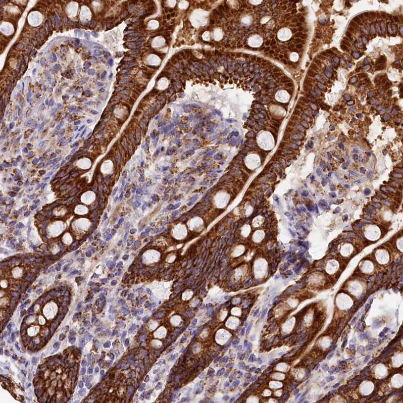 CLYBL Antibody - BSA Free Immunohistochemistry-Paraffin: CLYBL Antibody - BSA Free [NBP1-84453]