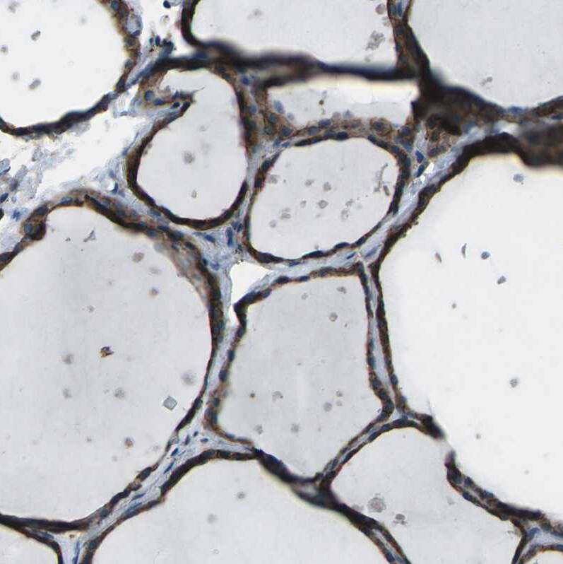 CMTM4 Antibody - BSA Free Immunohistochemistry-Paraffin: CMTM4 Antibody - BSA Free [NBP1-84457]