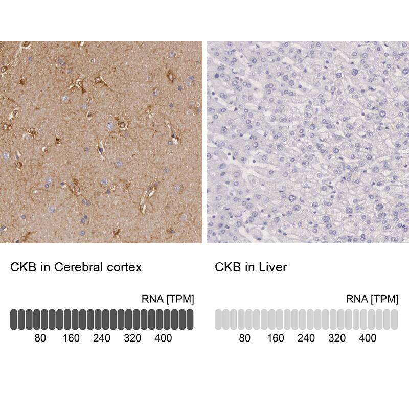 Creatine Kinase BB Antibody - BSA Free Immunohistochemistry-Paraffin: Creatine Kinase BB Antibody [NBP1-84460]