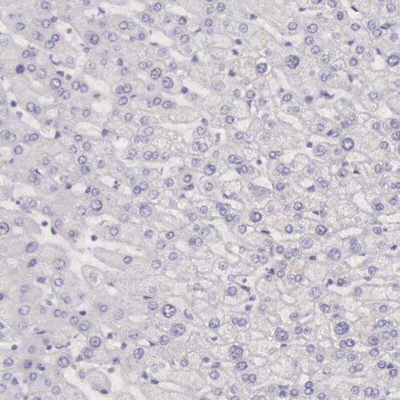 Creatine Kinase BB Antibody - BSA Free Immunohistochemistry-Paraffin: Creatine Kinase BB Antibody [NBP1-84460]