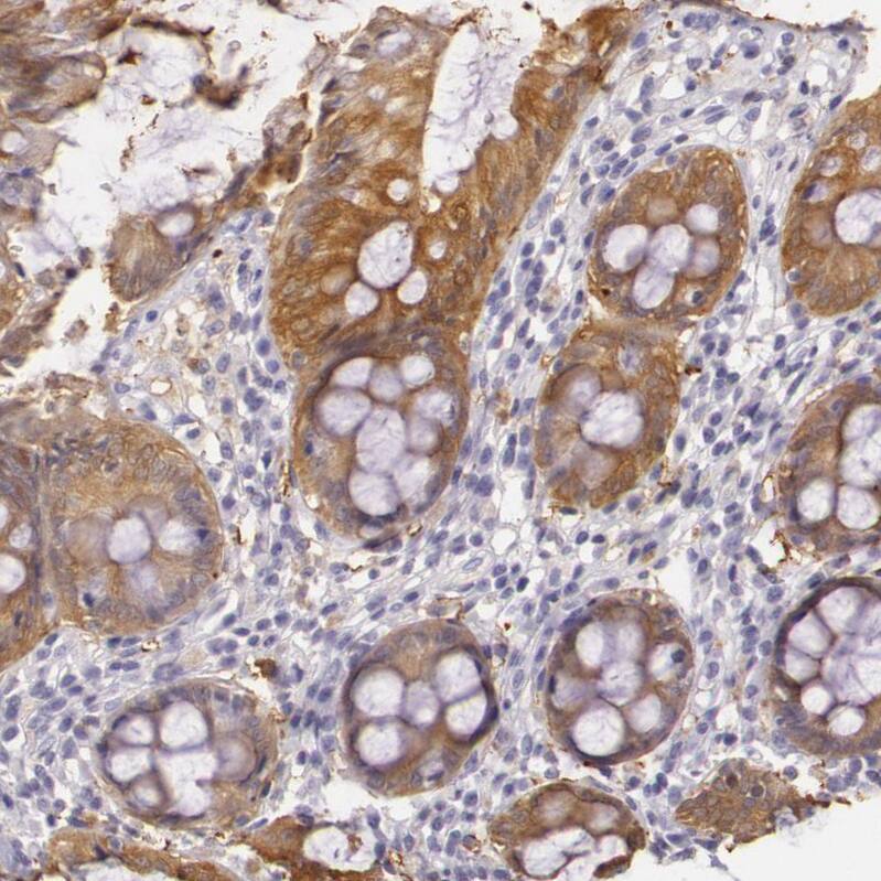 Creatine Kinase BB Antibody - BSA Free Immunohistochemistry-Paraffin: Creatine Kinase BB Antibody [NBP1-84460]