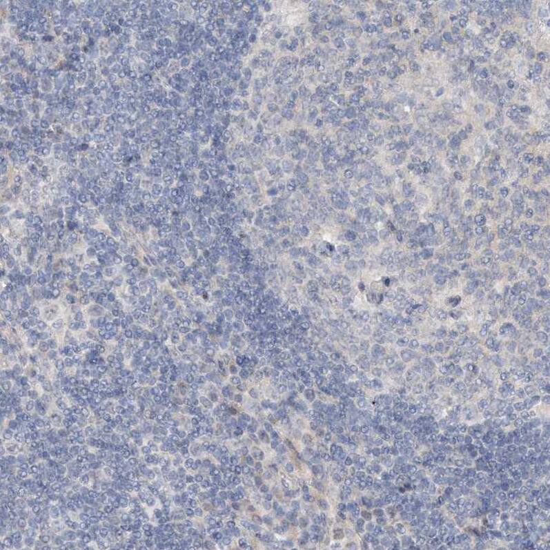 DNAH5 Antibody - BSA Free Immunohistochemistry-Paraffin: DNAH5 Antibody - BSA Free [NBP1-84464]