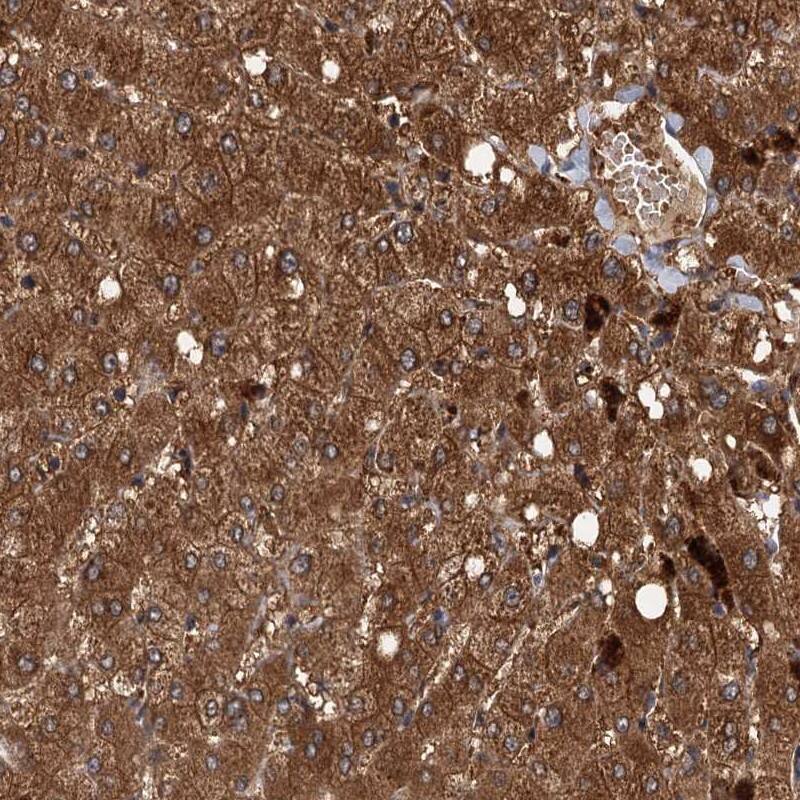 Viperin Antibody - BSA Free Immunohistochemistry-Paraffin: Viperin Antibody [NBP1-84467]