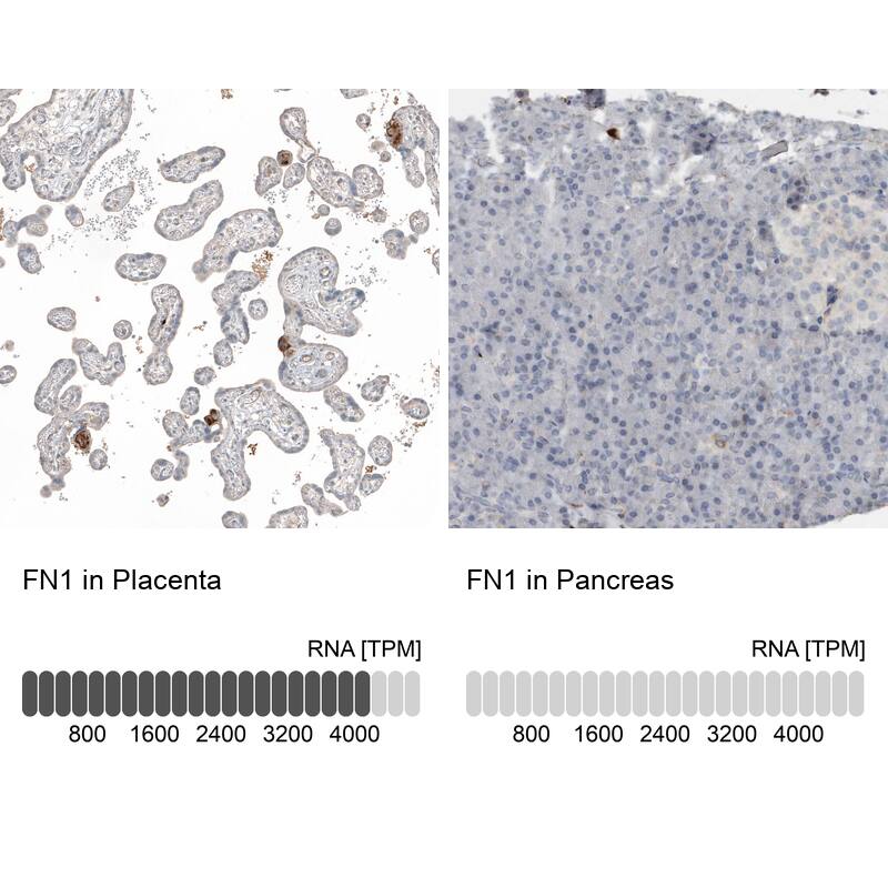 Fibronectin Antibody - BSA Free Immunohistochemistry-Paraffin: Fibronectin Antibody - BSA Free [NBP1-84468]