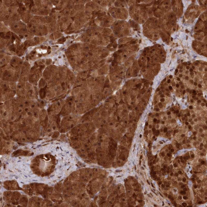 ABHD14B Antibody - BSA Free Immunohistochemistry-Paraffin: ABHD14B Antibody [NBP1-84472]