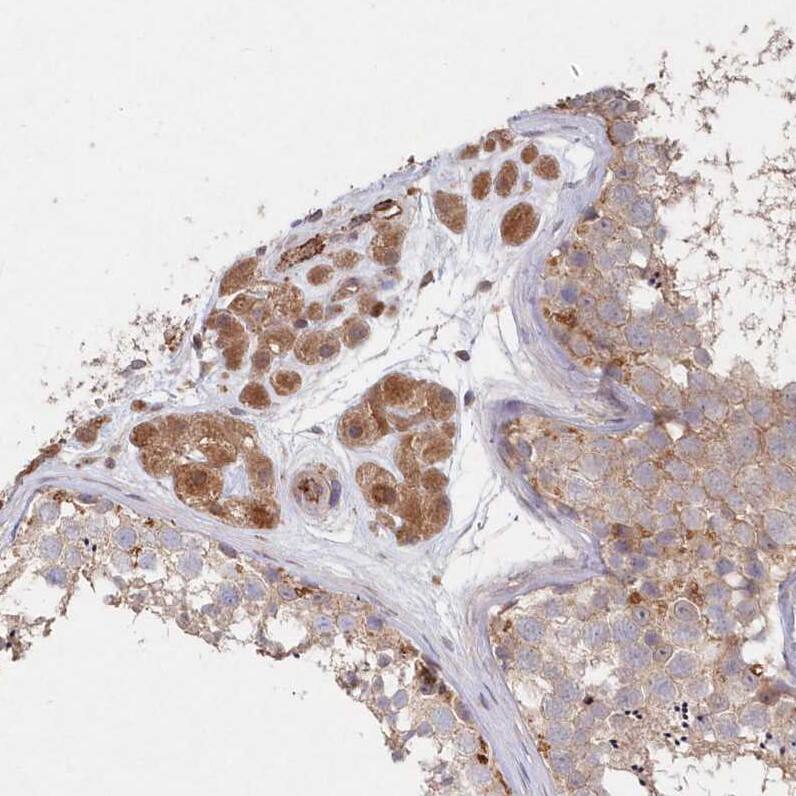 ABHD14B Antibody - BSA Free Immunohistochemistry-Paraffin: ABHD14B Antibody - BSA Free [NBP1-84473]