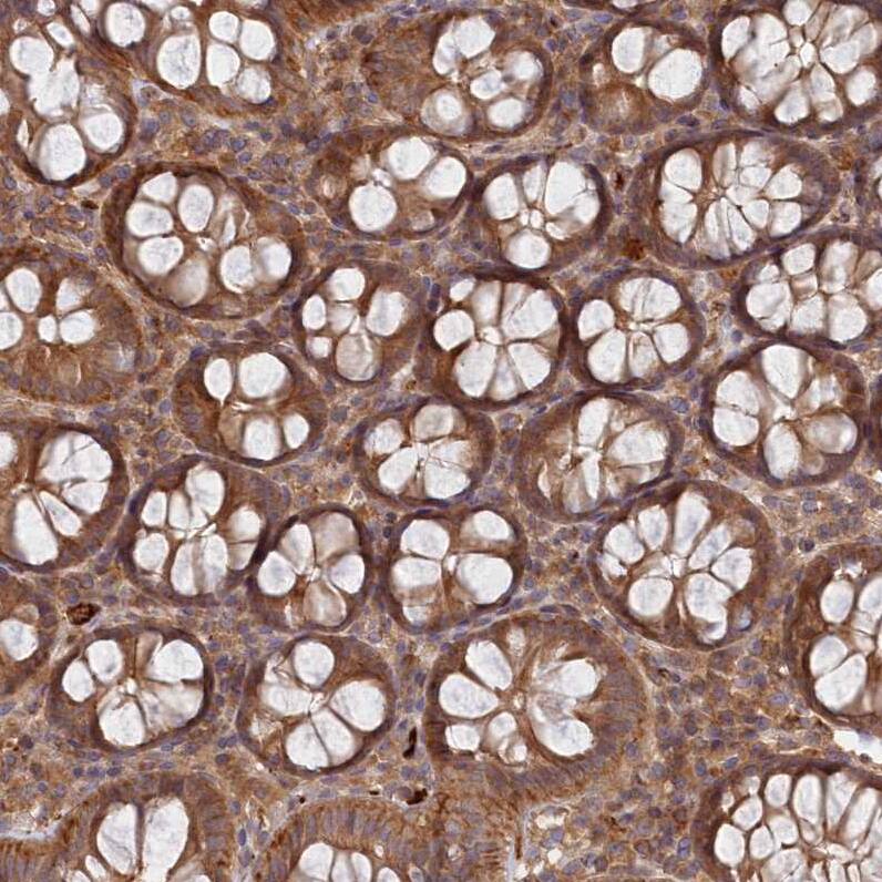 ABHD14B Antibody - BSA Free Immunohistochemistry-Paraffin: ABHD14B Antibody - BSA Free [NBP1-84473]