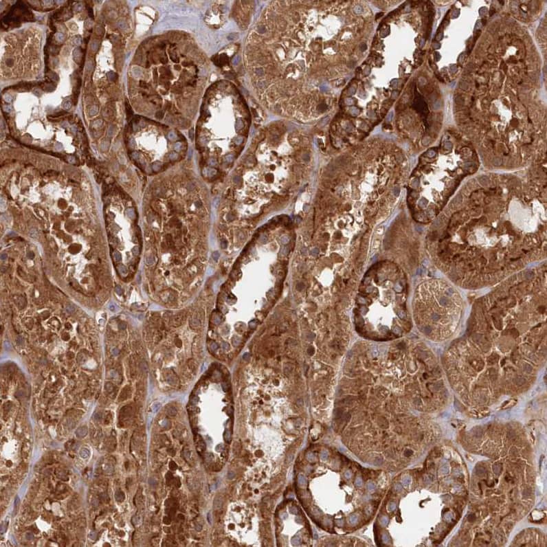 ABHD14B Antibody - BSA Free Immunohistochemistry-Paraffin: ABHD14B Antibody - BSA Free [NBP1-84473]