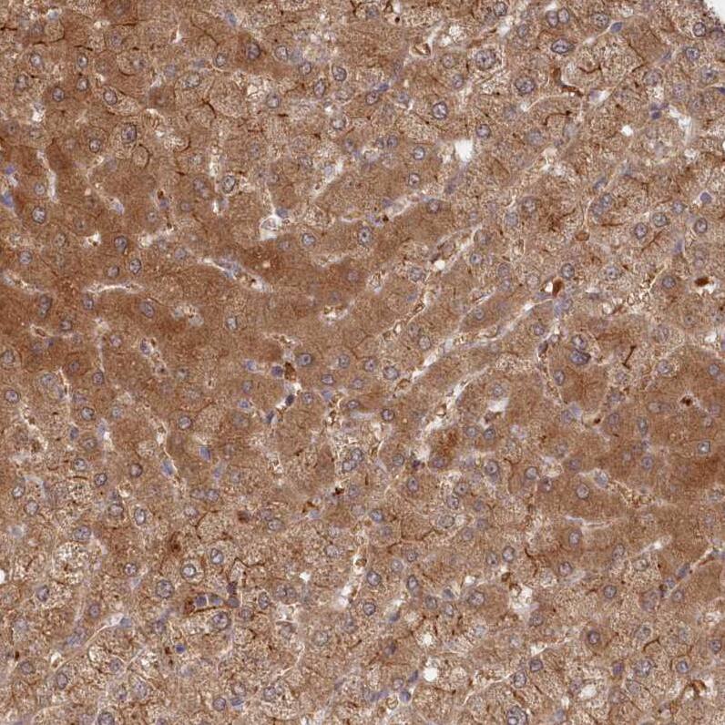 ABHD14B Antibody - BSA Free Immunohistochemistry-Paraffin: ABHD14B Antibody - BSA Free [NBP1-84473]
