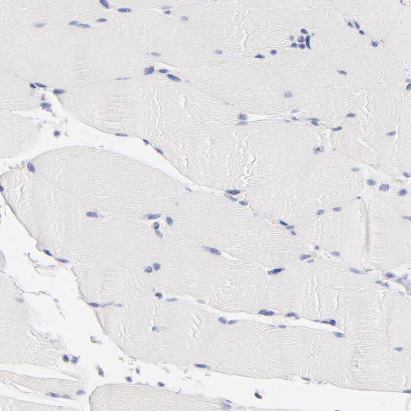 CHX10 Antibody - BSA Free Immunohistochemistry-Paraffin: CHX10 Antibody [NBP1-84476]