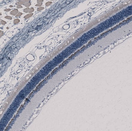 CHX10 Antibody - BSA Free Immunohistochemistry-Paraffin: CHX10 Antibody [NBP1-84476]