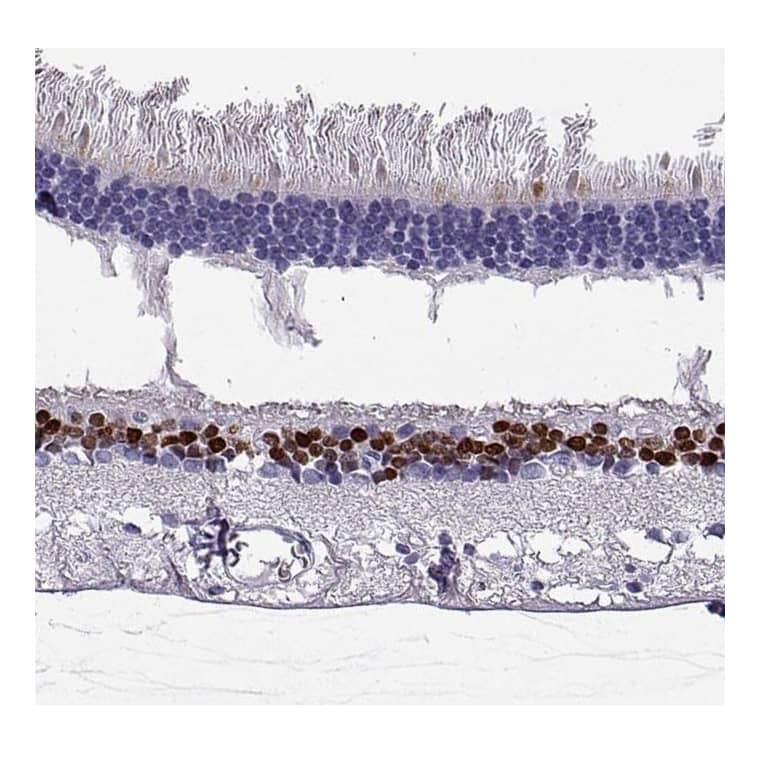 CHX10 Antibody - BSA Free Immunohistochemistry-Paraffin: CHX10 Antibody [NBP1-84476]