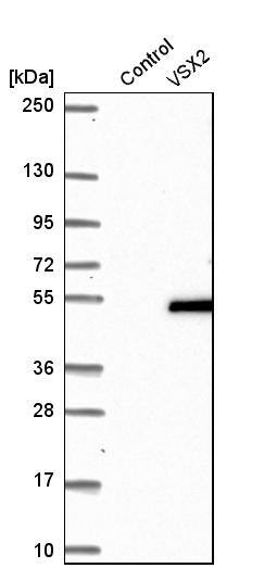 CHX10 Antibody - BSA Free Western Blot: CHX10 Antibody - BSA Free [NBP1-84476]