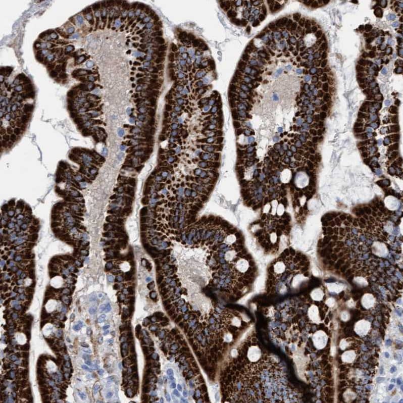 Mitochondrial fission regulator 1 Antibody - BSA Free Immunohistochemistry-Paraffin: Mitochondrial fission regulator 1 Antibody - BSA Free [NBP1-84480]