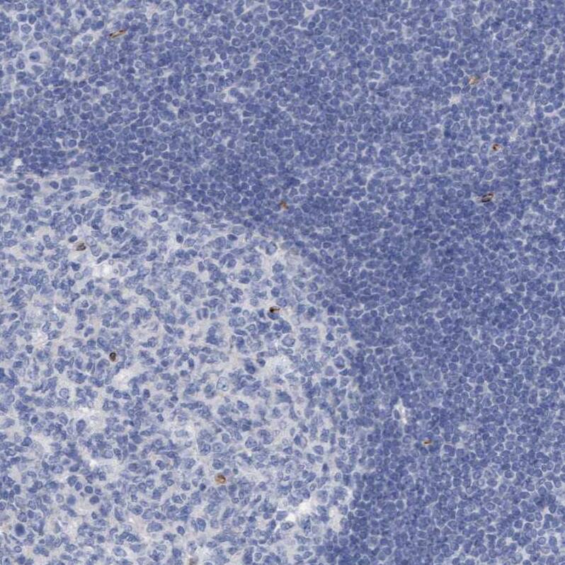 Mitochondrial fission regulator 1 Antibody - BSA Free Immunohistochemistry-Paraffin: Mitochondrial fission regulator 1 Antibody - BSA Free [NBP1-84480]