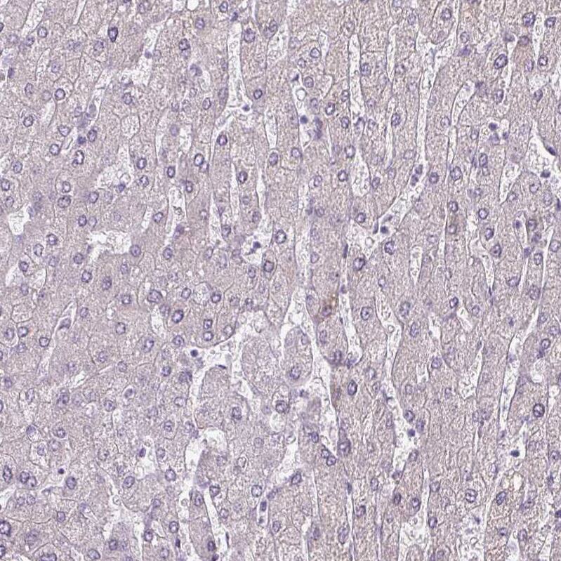 Chordin-like 1/CHRDL1 Antibody - BSA Free Immunohistochemistry-Paraffin: Chordin-like 1/CHRDL1 Antibody - BSA Free [NBP1-84485]